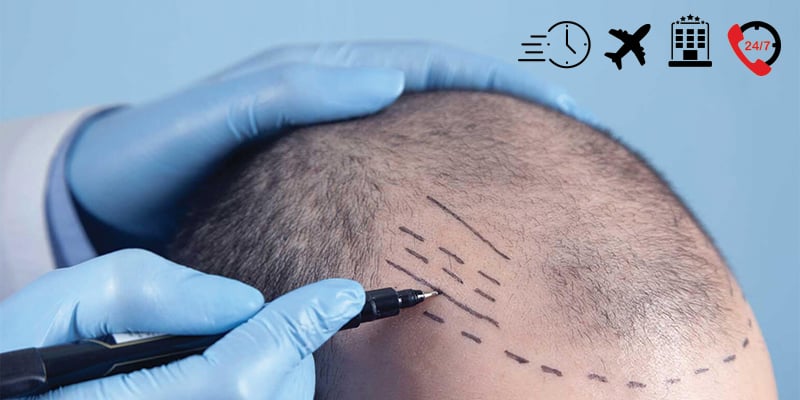 hizli-sac-ekiminin-faydalari-nelerdir