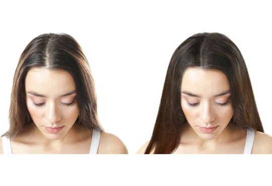 kadinlarda-sac-ekimi-yapilir-mi