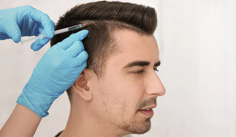 sac-prp-uygulamalari